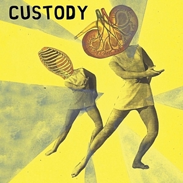 Custody, Custody