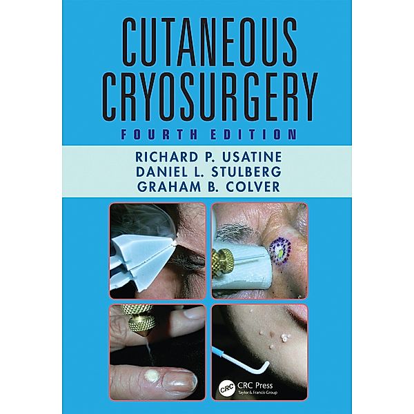 Cutaneous Cryosurgery, Richard P. Usatine, Daniel L. Stulberg, Graham B. Colver