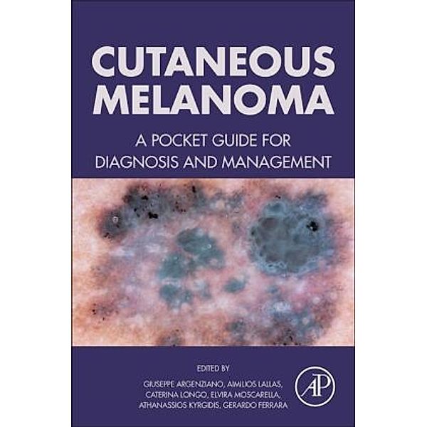 Cutaneous Melanoma