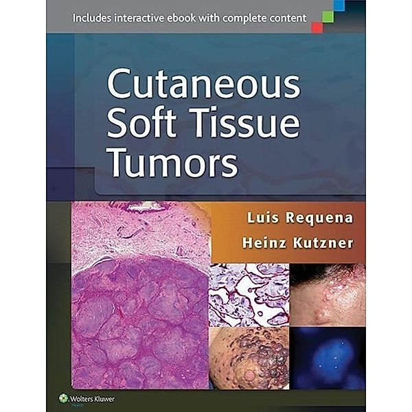 Cutaneous Soft Tissue Tumors, Luis Requena