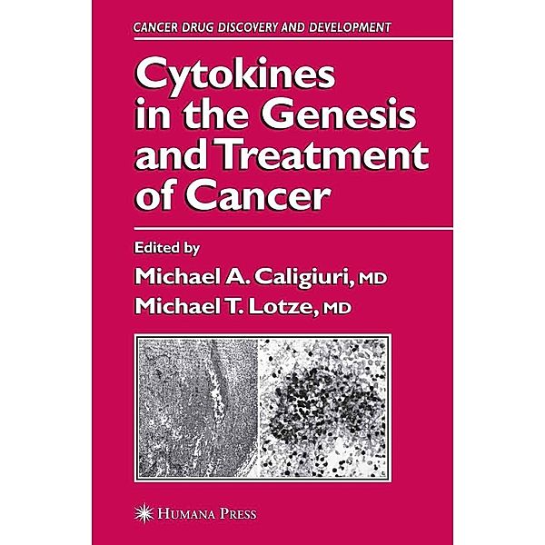 Cytokines in the Genesis and Treatment of Cancer / Cancer Drug Discovery and Development