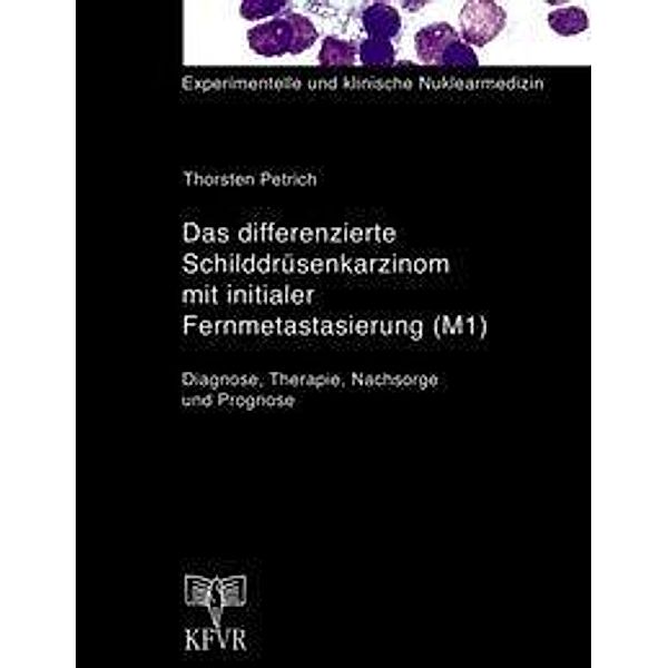 Das differenzierte Schilddrüsenkarzinom mit initialer Fernmetastasierung (M1), Thorsten Petrich