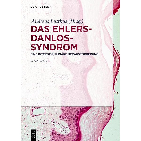 Das Ehlers-Danlos-Syndrom