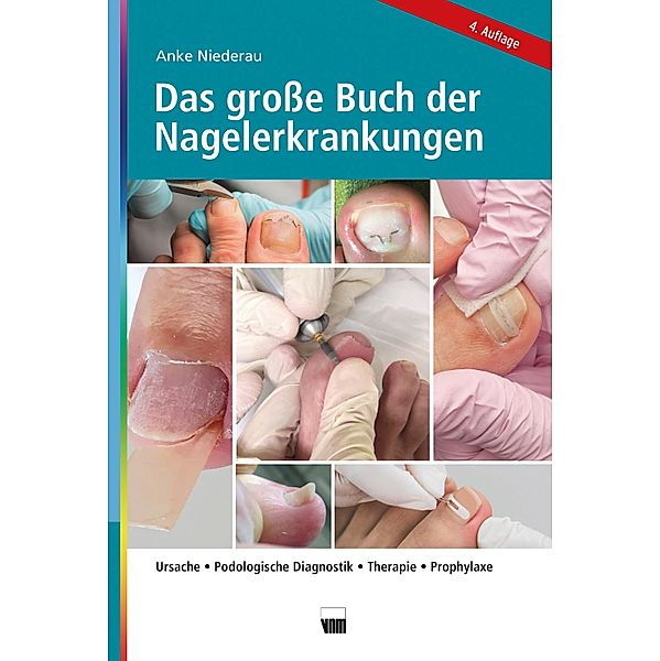 Das große Buch der Nagelerkrankungen, Anke Niederau