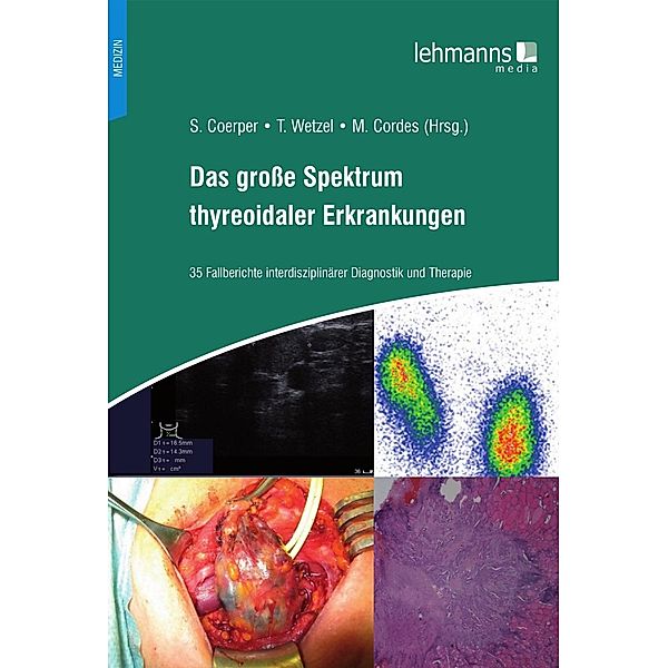 Das große Spektrum thyreoidaler Erkrankungen, Cordes M., Stephan Coerper, Wetzel Tobias