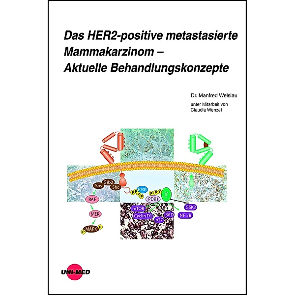 Das HER2-positive metastasierte Mammakarzinom - Aktuelle Behandlungskonzepte / UNI-MED Science, Manfred Welslau