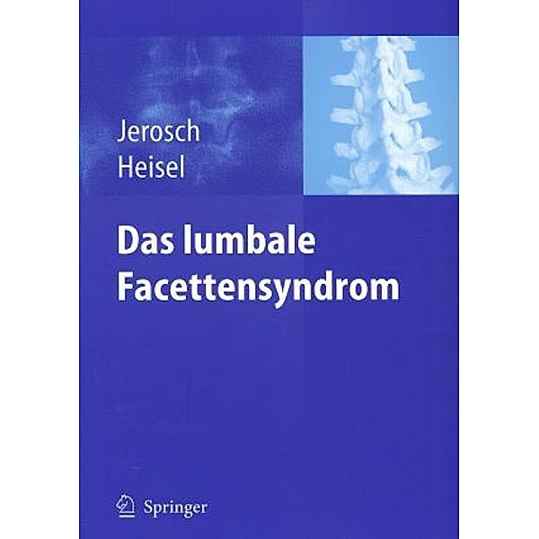 Das lumbale Facettensyndrom, Jörg Jerosch, Jürgen Heisel