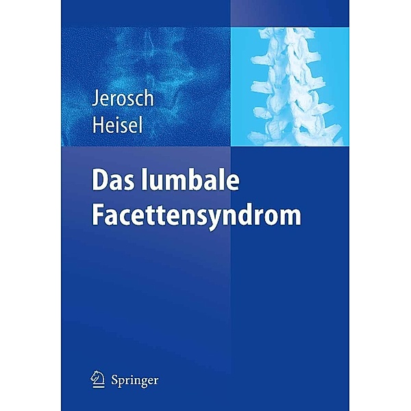 Das lumbale Facettensyndrom, Jörg Jerosch, Jürgen Heisel