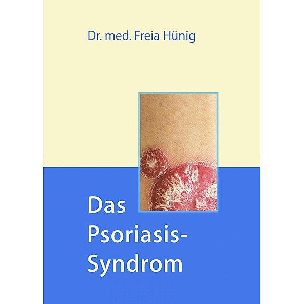Das Psoriasis-Syndrom, Freia Hünig