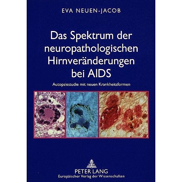 Das Spektrum der neuropathologischen Hirnveränderungen bei AIDS, Eva Neuen-Jacob