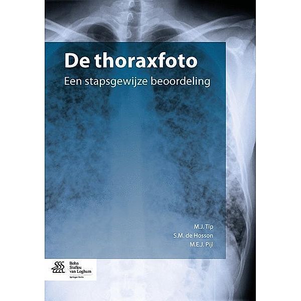 De thoraxfoto