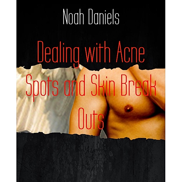 Dealing with Acne Spots and Skin Break Outs, Noah Daniels