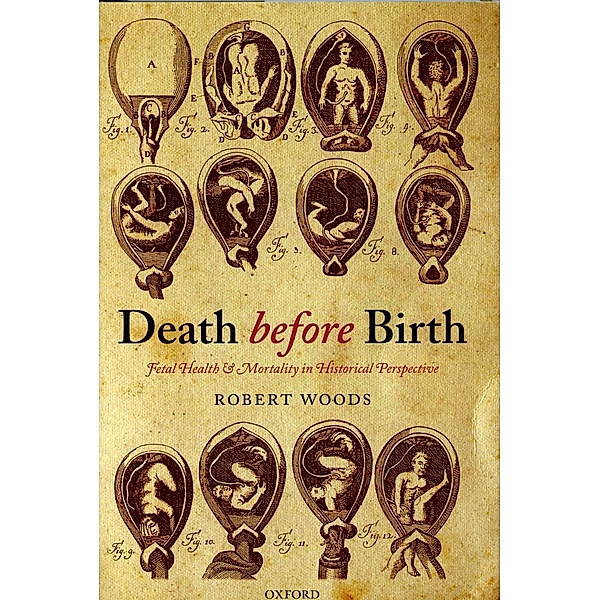 Death before Birth, Robert Woods