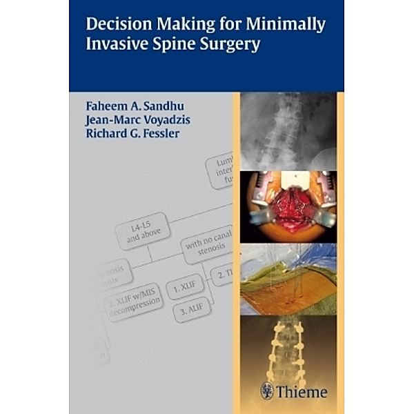Decision Making for Minimally Invasive Spine Surgery, Faheem A. Sandhu, Jean-Marc Voyadzis, Richard G. Fessler