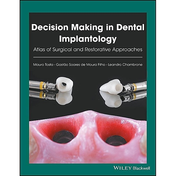 Decision Making in Dental Implantology, Mauro Tosta, Gastão Soares de Moura Filho, Leandro Chambrone