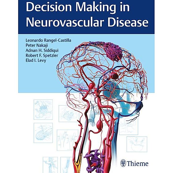 Decision Making in Neurovascular Disease, Leonardo Rangel-Castilla, Peter Nakaji, Adnan H. Siddiqui, Robert F. Spetzler, Elad I. Levy