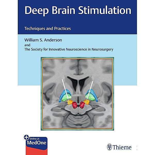 Deep Brain Stimulation, William S. Anderson, The Society for Innovative Neuroscience