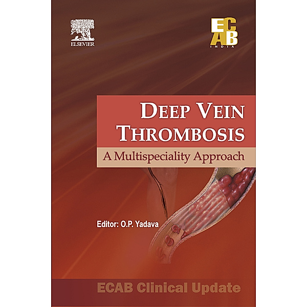 Deep Vein Thrombosis - ECAB