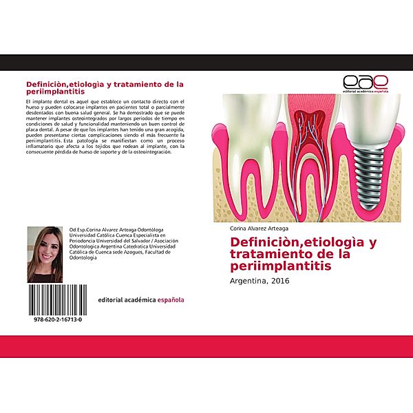 Definiciòn,etiologìa y tratamiento de la periimplantitis, Corina Alvarez Arteaga