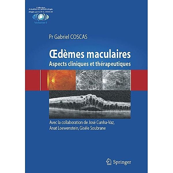 dèmes maculaires