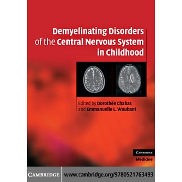 Demyelinating Disorders of the Central Nervous System in Childhood