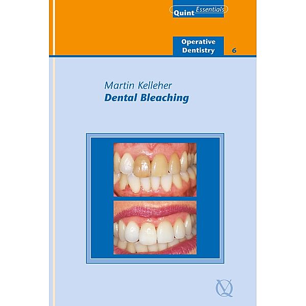 Dental Bleaching / QuintEssentials of Dental Practice Bd.38, Martin Kelleher