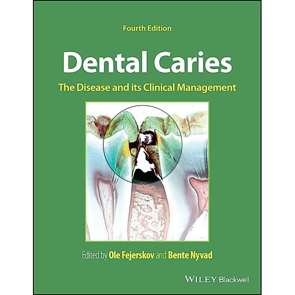 Dental Caries