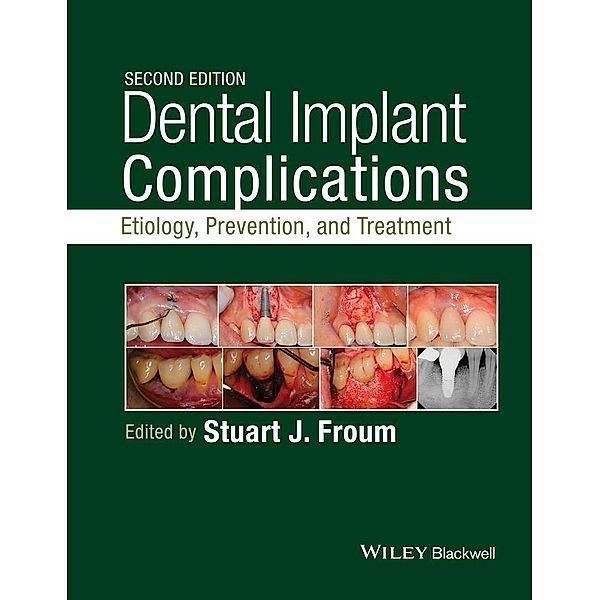 Dental Implant Complications