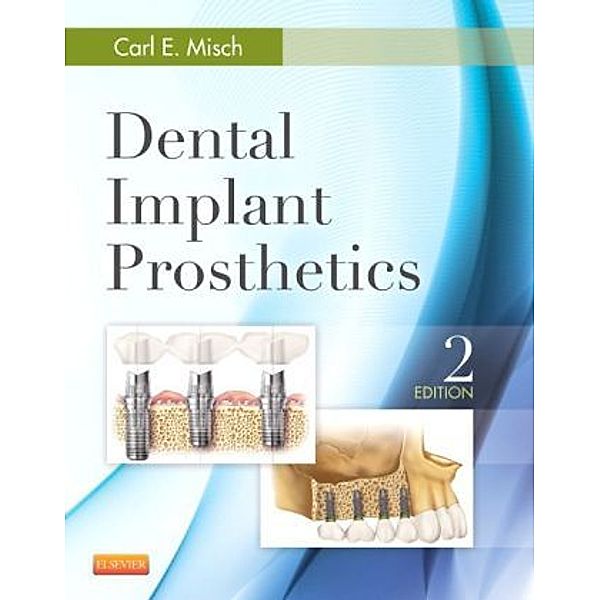 Dental Implant Prosthetics, Carl E. Misch