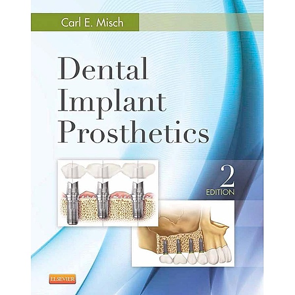 Dental Implant Prosthetics - E-Book, Carl E. Misch