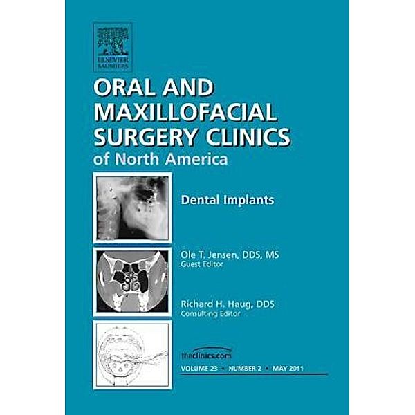 Dental Implants, An Issue of Oral and Maxillofacial Surgery Clinics, Ole Jensen