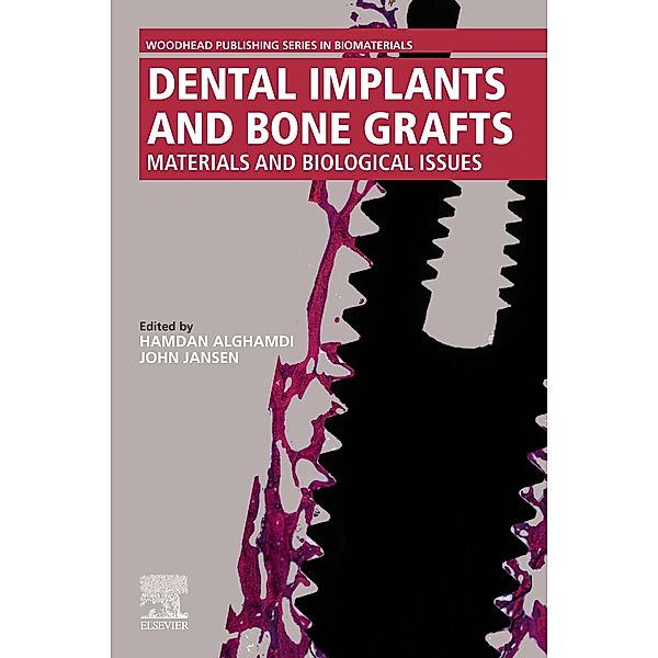Dental Implants and Bone Grafts