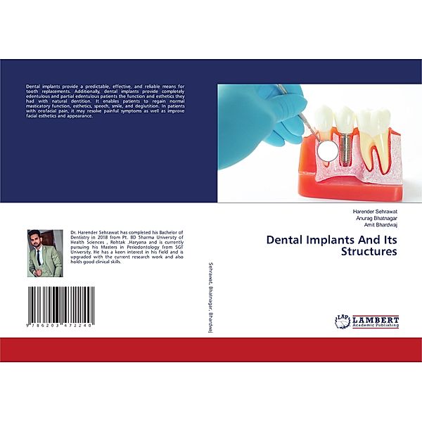 Dental Implants And Its Structures, Harender Sehrawat, Anurag Bhatnagar, Amit Bhardwaj