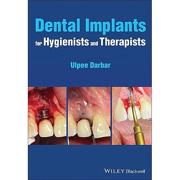 Dental Implants for Hygienists and Therapists, Ulpee R. Darbar