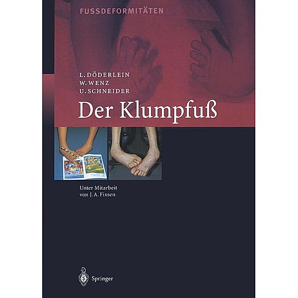 Der Klumpfuss, Leonhard Döderlein, Wolfram Wenz, Urs Schneider