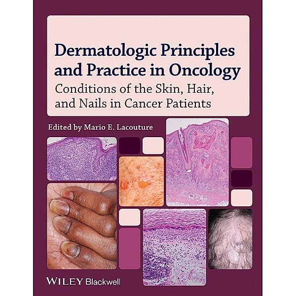 Dermatologic Principles and Practice in Oncology, Mario E. Lacouture