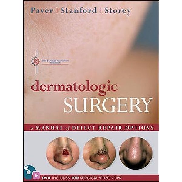 Dermatologic Surgery, w. DVD-Video, Robert Paver, Duncan Stanford, Leslie Storey