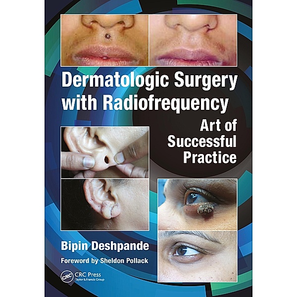 Dermatologic Surgery with Radiofrequency, Bipin Deshpande