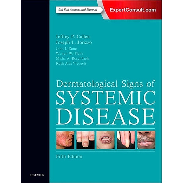Dermatological Signs of Systemic Disease E-Book, Jeffrey P. Callen, Joseph L. Jorizzo, John J. Zone, Warren Piette, Misha A. Rosenbach, Ruth Ann Vleugels
