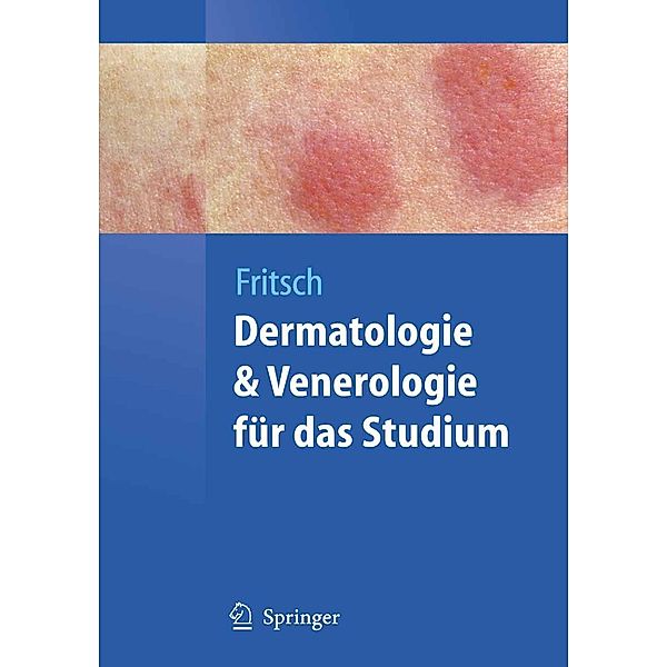 Dermatologie und Venerologie für das Studium / Springer-Lehrbuch, Peter Fritsch