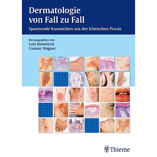 Dermatologie von Fall zu Fall, Lutz Kowalzick, Gunnar Wagner