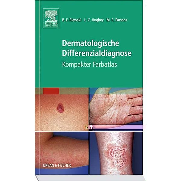 Dermatologische Differenzialdiagnose, Boni E. Elewski, Lauren C. Hughey, Margaret E. Parsons