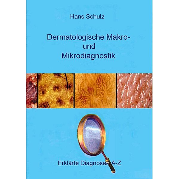 Dermatologische Makro- und Mikrodiagnostik / Erklärte Diagnosen Bd.3, Hans Schulz