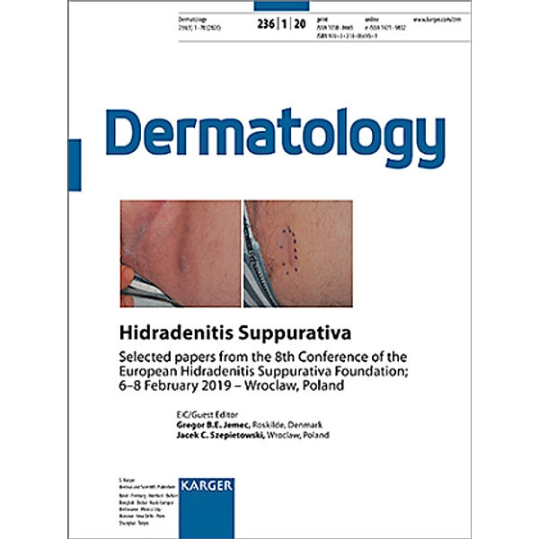 Dermatology: 236/1 Hidradenitis Suppurativa