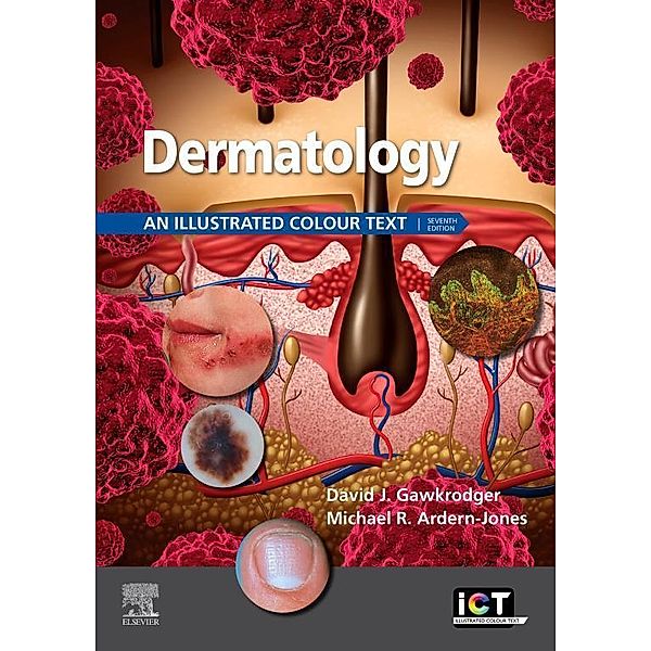 Dermatology E-Book, David Gawkrodger, Michael R. Ardern-Jones