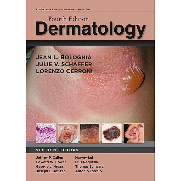 Dermatology E-Book, Jean L. Bolognia, Julie V. Schaffer, Lorenzo Cerroni