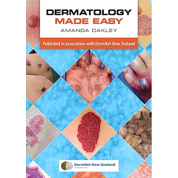 Dermatology Made Easy / Scion Publishing, Amanda Oakley