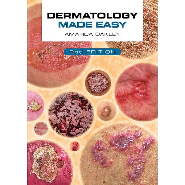 Dermatology Made Easy, second edition, Amanda Oakley