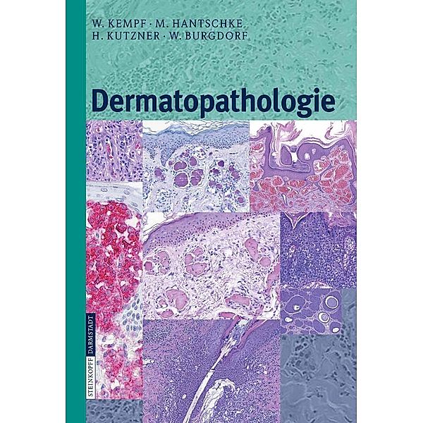 Dermatopathologie, W. Kempf, Markus Hantschke, H. Kutzner, W. Burgdorf