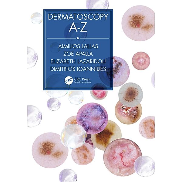Dermatoscopy A-Z, Aimilios Lallas, Zoe Apalla, Elizabeth Lazaridou, Dimitrios Ioannides